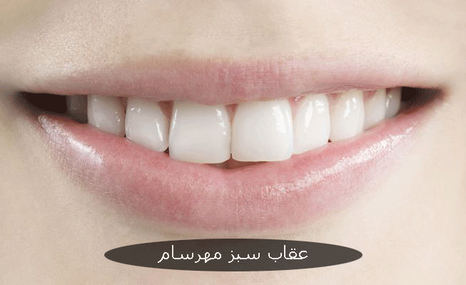 استویا و سفیدی دندان